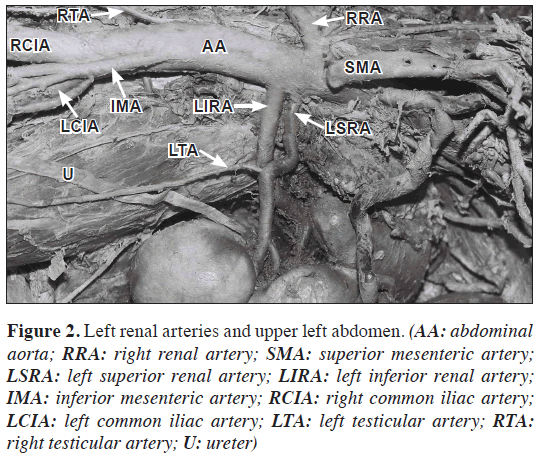 anatomical-variations-left-abdomen