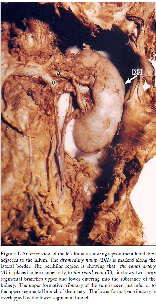 anatomical-variations-left-kidney