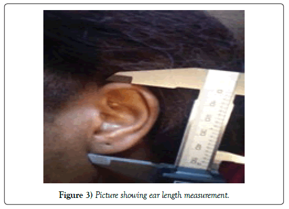 anatomical-variations-length-measurement