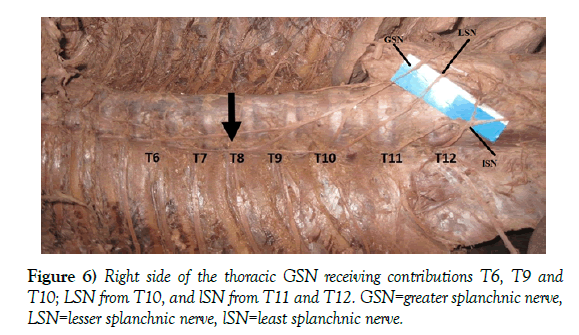 anatomical-variations-lesser-splanchnic