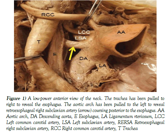 anatomical-variations-low-power