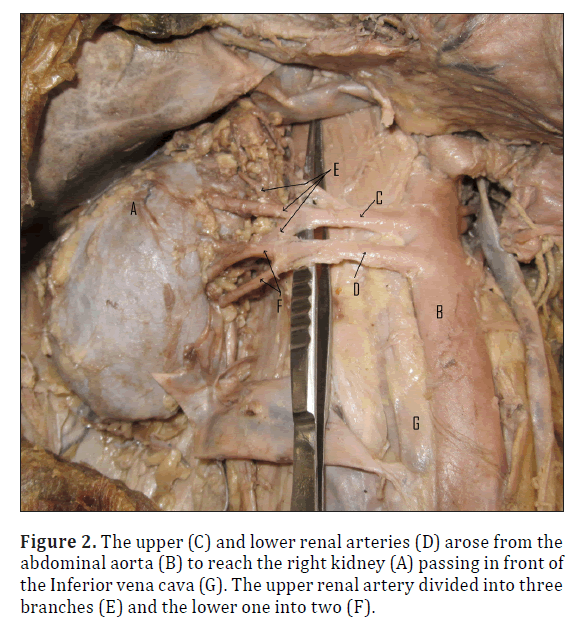 anatomical-variations-lower-renal