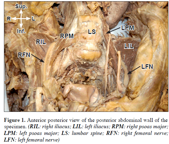 anatomical-variations-lumbar-spine