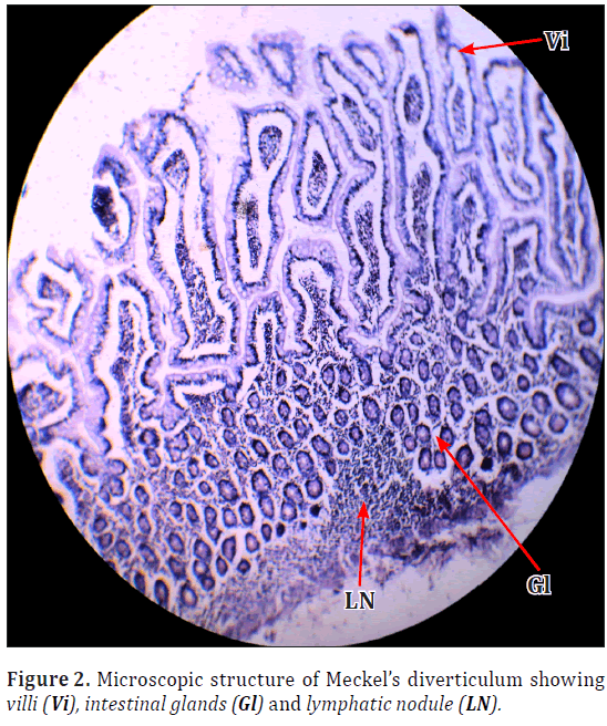 anatomical-variations-lymphatic-nodule