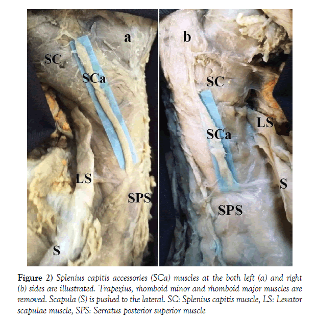 anatomical-variations-major-muscles