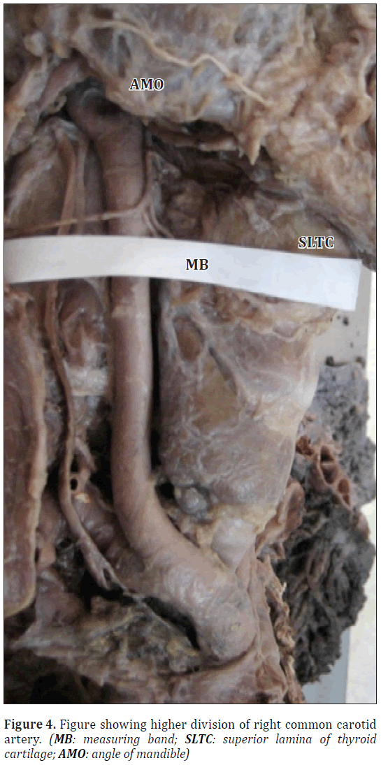 anatomical-variations-measuring-band