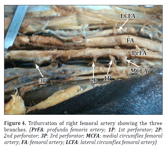 anatomical-variations-medial-circumflex