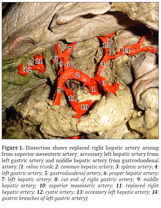anatomical-variations-mesenteric-artery