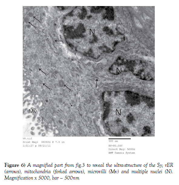 anatomical-variations-multiple-nuclei