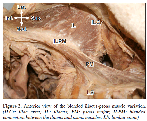 anatomical-variations-muscle-blended