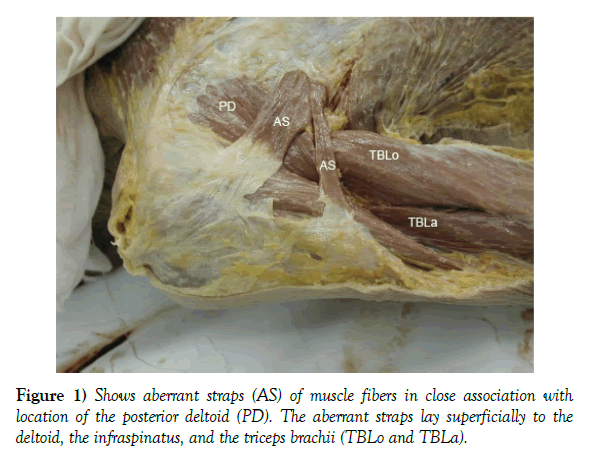 anatomical-variations-muscle-fibers