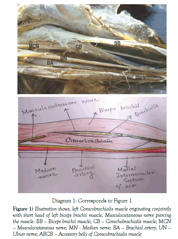 anatomical-variations-muscle-originating