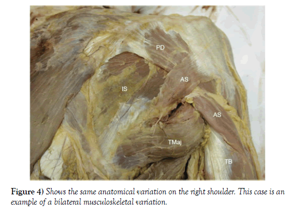 anatomical-variations-musculoskeletal-variation