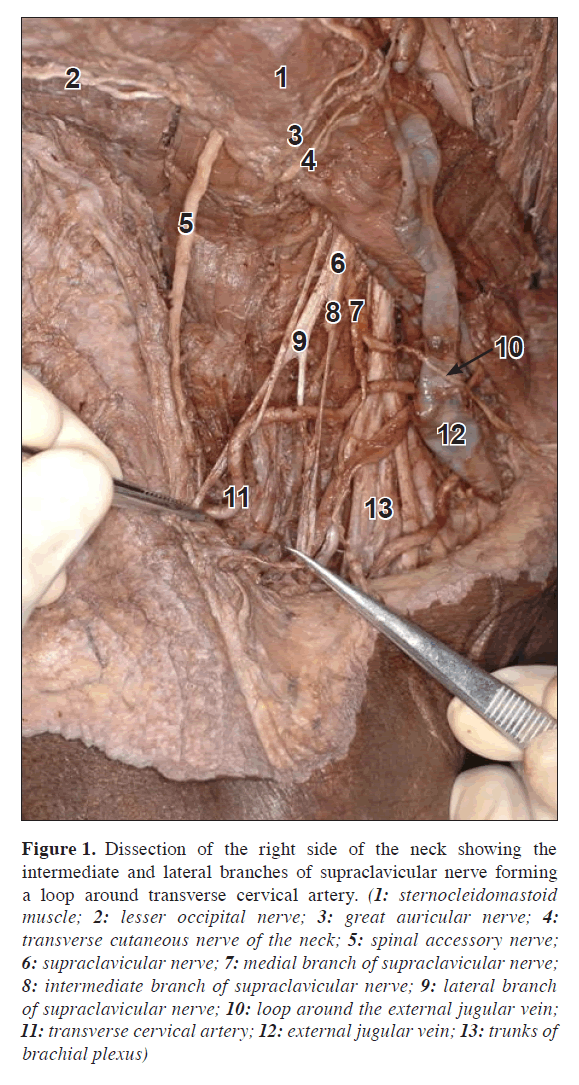 anatomical-variations-nerve-forming