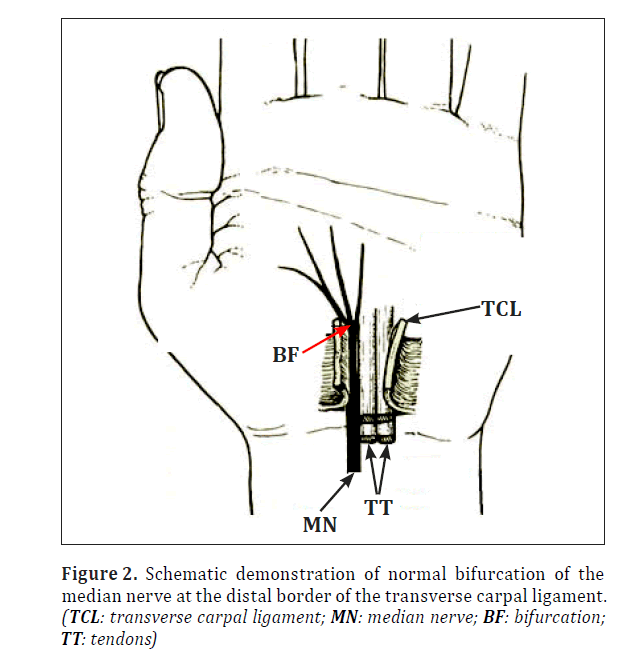 anatomical-variations-normal-bifurcation