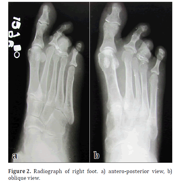 anatomical-variations-oblique-view