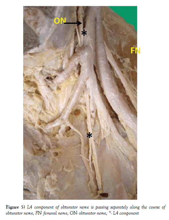 anatomical-variations-obturator-nerve