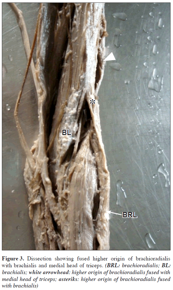 anatomical-variations-origin-medial