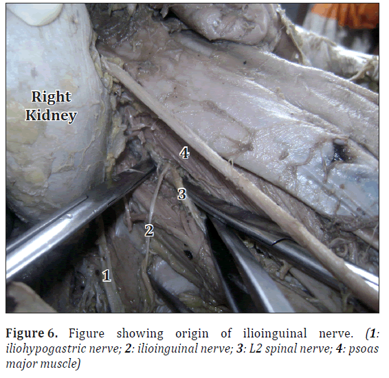 anatomical-variations-origin-nerve
