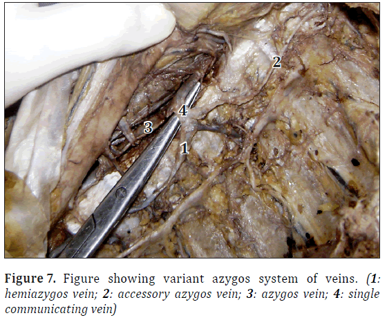 anatomical-variations-origin-nerve