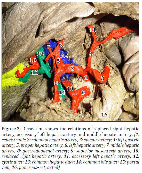 anatomical-variations-pancreas-retracted