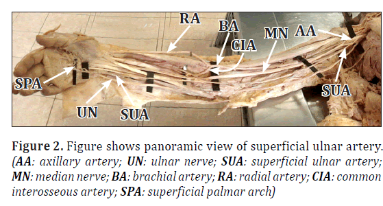 anatomical-variations-panoramic-view