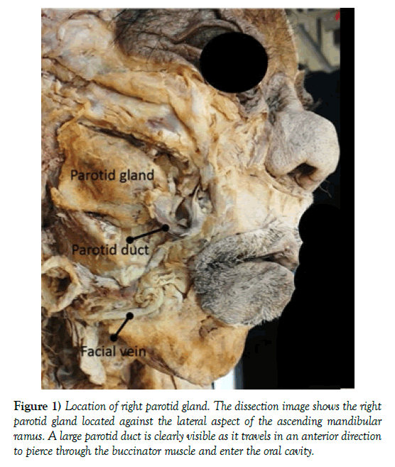 anatomical-variations-parotid-gland