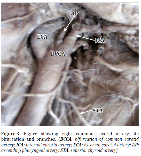 anatomical-variations-pharyngeal-artery