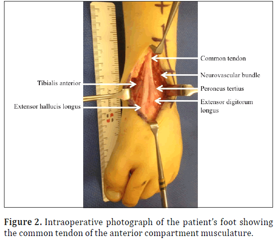 anatomical-variations-photograph-foot