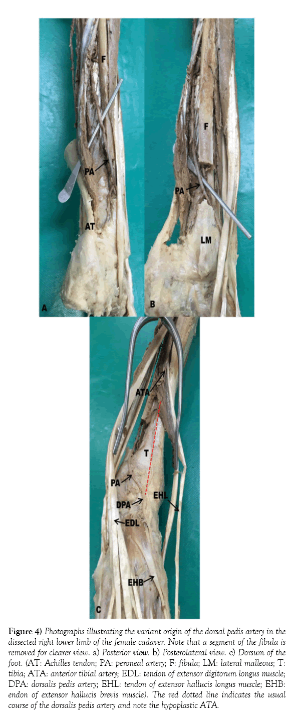 anatomical-variations-photographs-illustrating