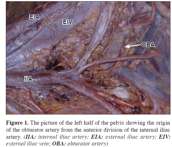 anatomical-variations-picture-left