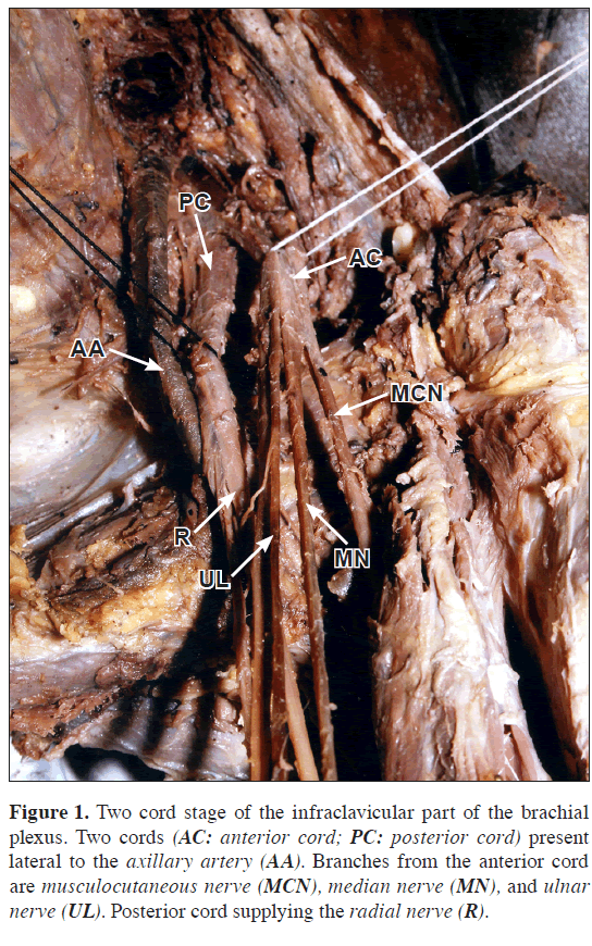 anatomical-variations-posterior