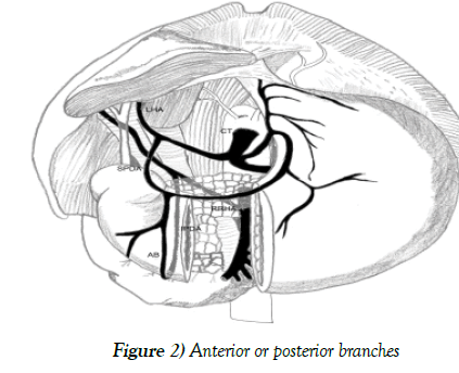 anatomical-variations-posterior-branches