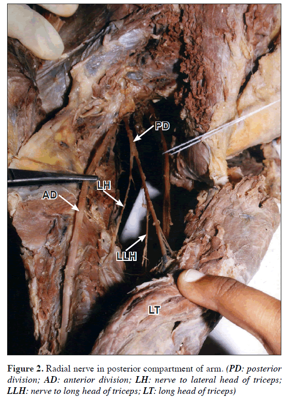 anatomical-variations-posterior-compartment