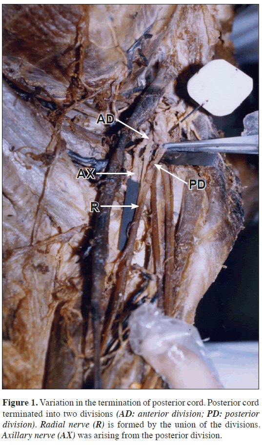 anatomical-variations-posterior-cord