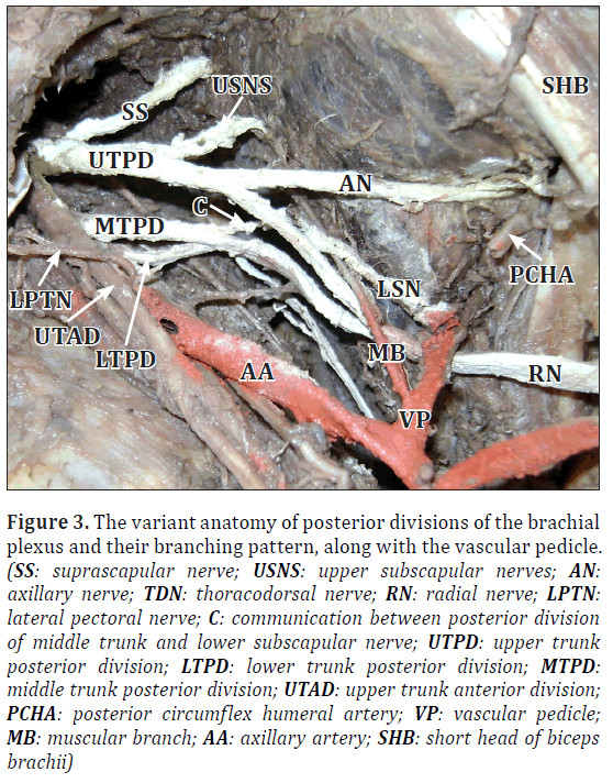 anatomical-variations-posterior-division