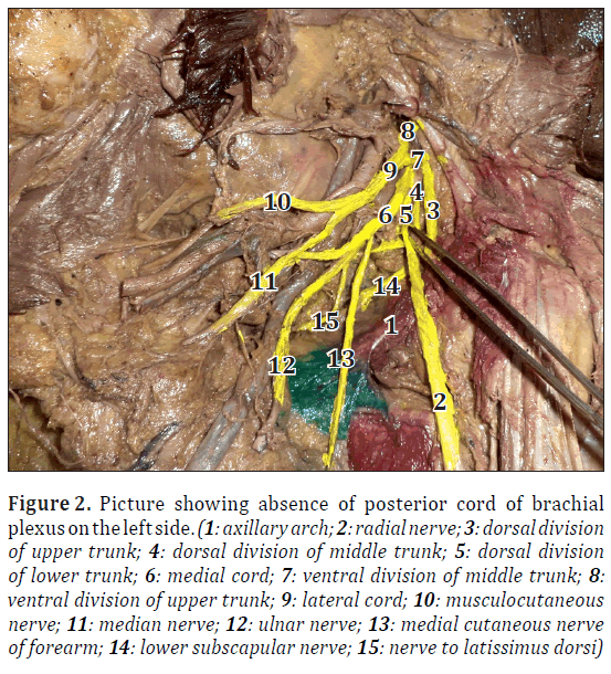 anatomical-variations-posterior-plexus