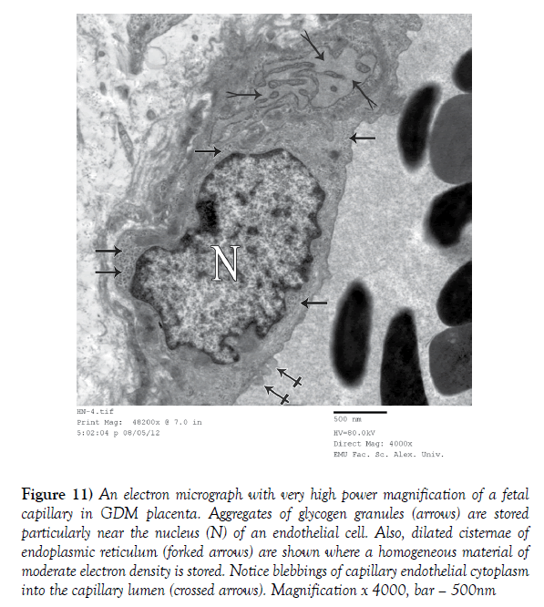 anatomical-variations-power-magnification