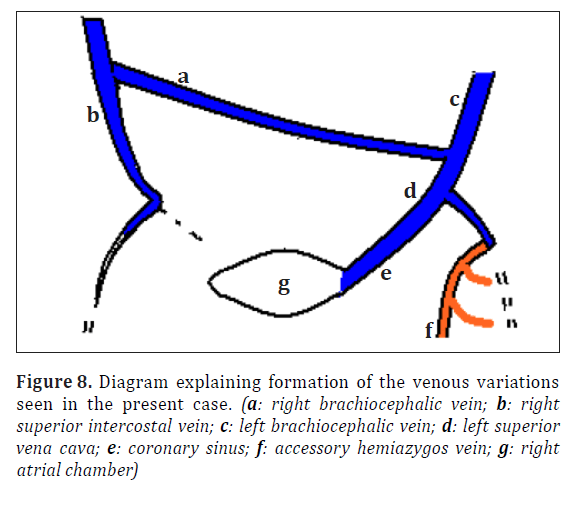 anatomical-variations-present-case