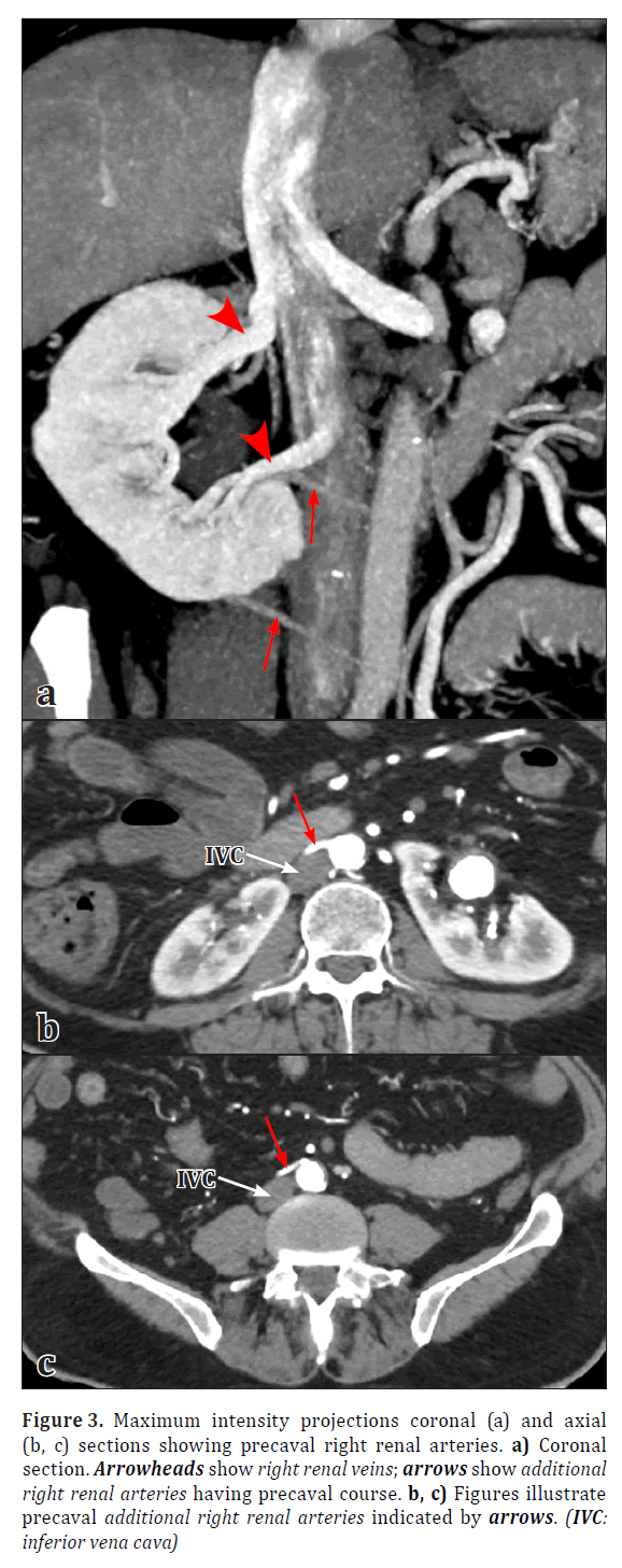 anatomical-variations-projections-coronal