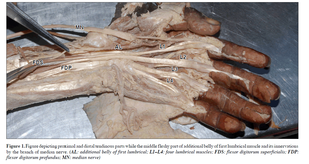 anatomical-variations-proximal-distal