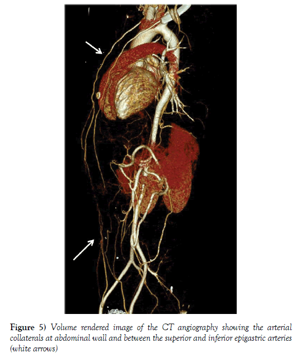 anatomical-variations-rendered-image