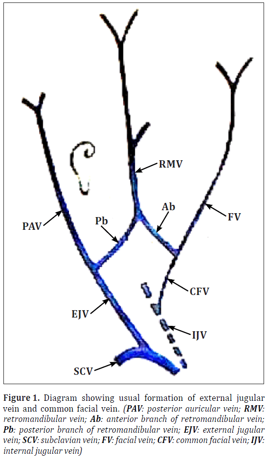 anatomical-variations-retromandibular-vein