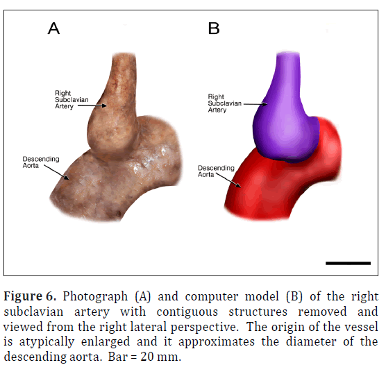 anatomical-variations-right-lateral