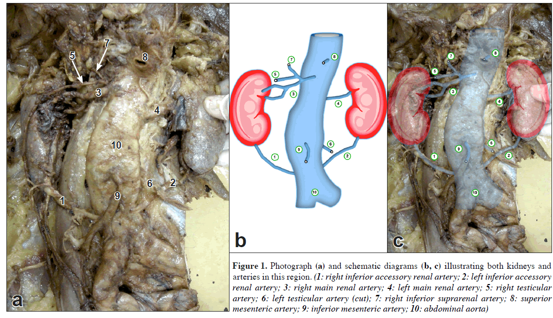 anatomical-variations-schematic-diagrams