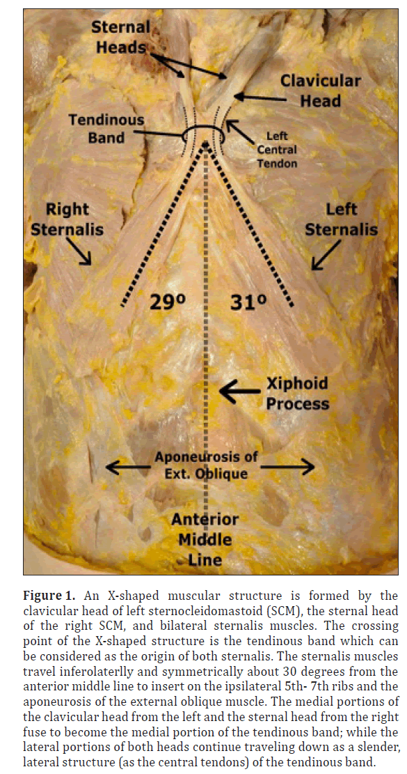 anatomical-variations-shaped-muscular