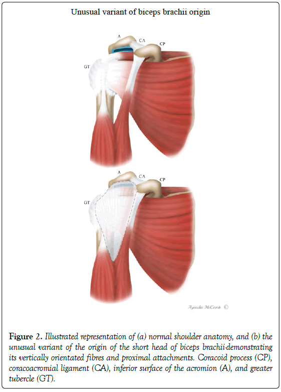 anatomical-variations-shoulder-anatomy