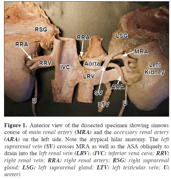 anatomical-variations-specimen
