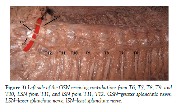 anatomical-variations-splanchnic