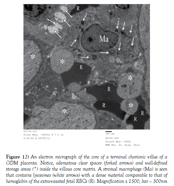 anatomical-variations-storage-areas